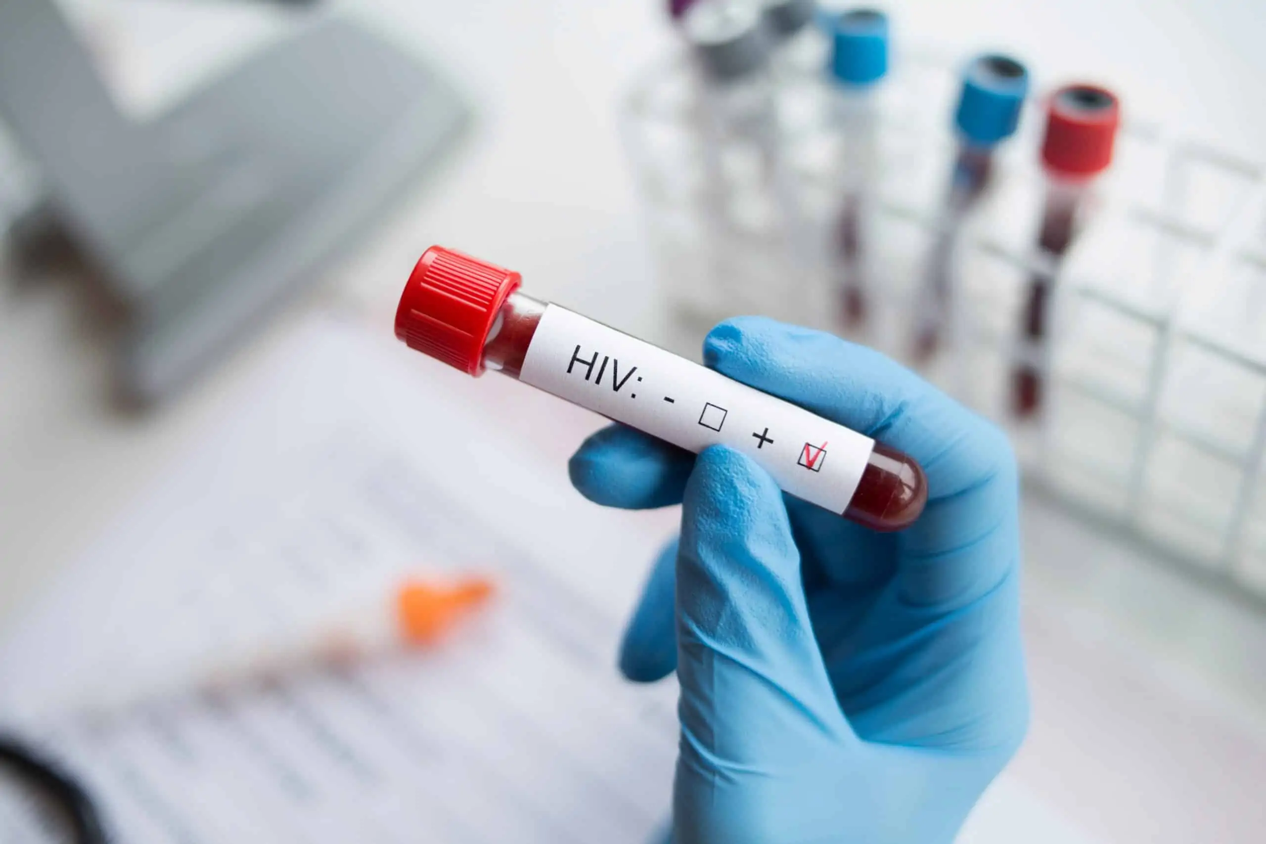 Nedjelja testiranja na HIV i hepatitise