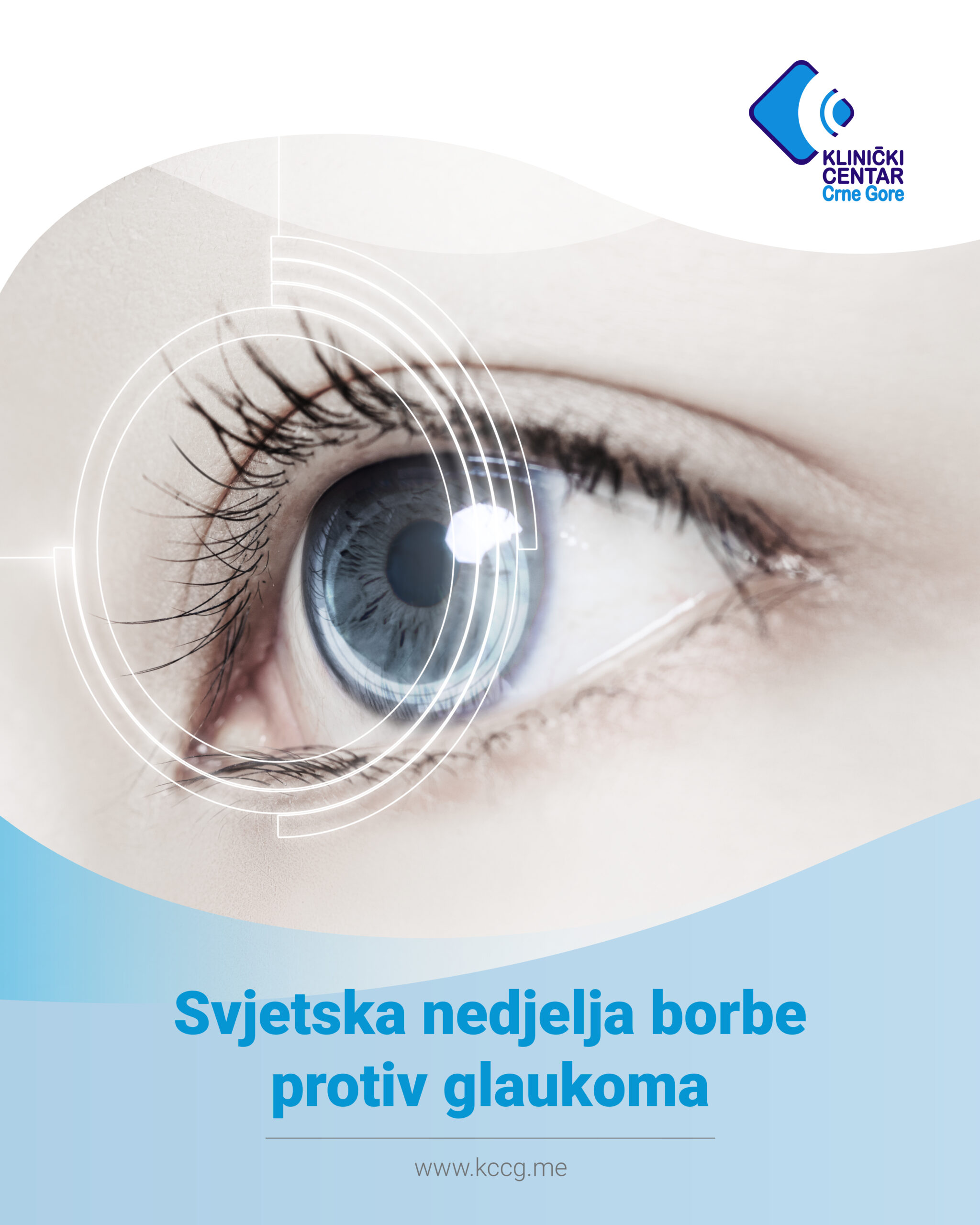 Klinički centar Crne Gore: Svjetska nedjelja borbe protiv glaukoma